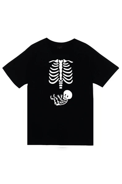 fame-stoned  Unisex Siyah İskelet Rib Cage Kurukafa Baskılı T-shirt